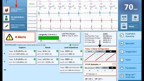 Deactivation and reactivation of ICD