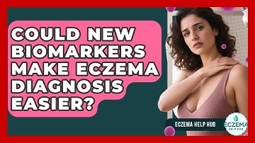 Could New Biomarkers Make Eczema Diagnosis Easier? - Eczema Help Hub