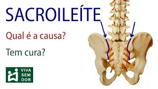 Sacroileíte - Qual é a causa? Tem cura?