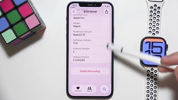 Apple Watch: How to Delete ECG Records