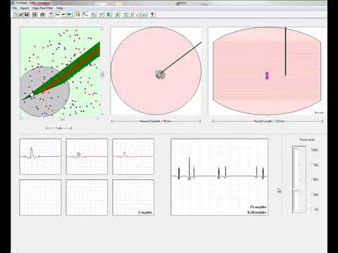 EMG Simulator