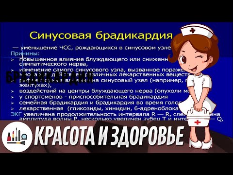 Брадикардия