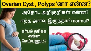 overian cyct and polyps in tamil | ovarian cyst signs and symptoms in tamil | garba pai katti