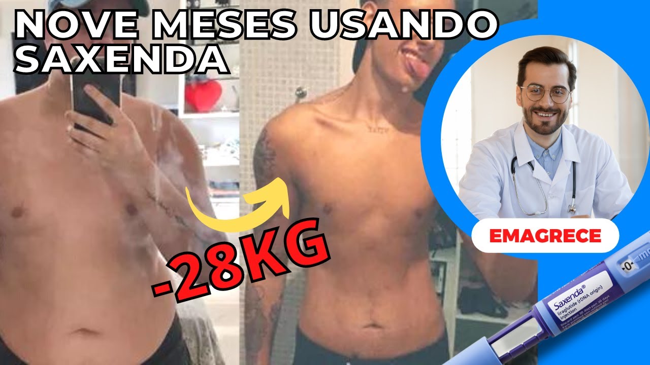nove-meses-usando-saxenda-quais-foram-os-resultados-e-quais-os-efeitos