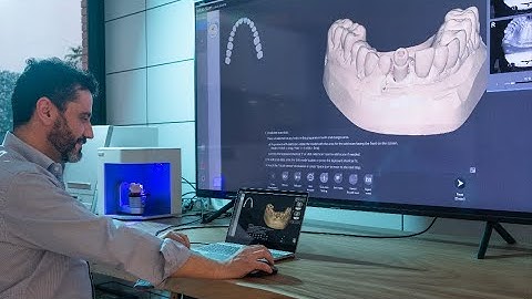 DESS® Libraries Installation - Exocad