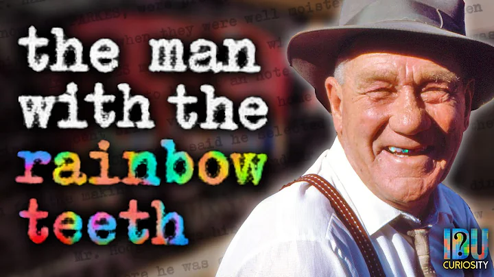 Harold's Opal Teeth Part II: A Detailed Denture De...