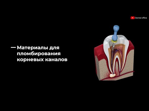 Материалы для пломбирования корневых каналов |  Materials for filling root canals |Материаловедение