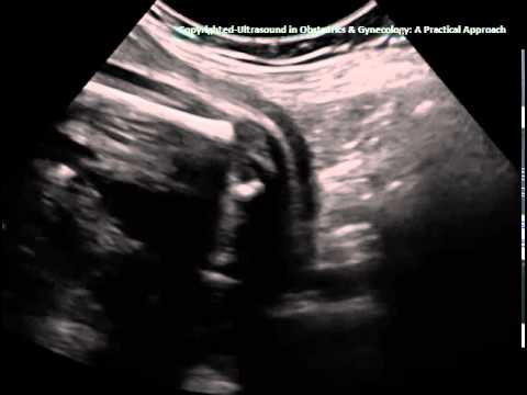 Ultrasound A Practical Approach