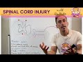 Spinal Cord Injury | What happens in the spinal cord after injury?