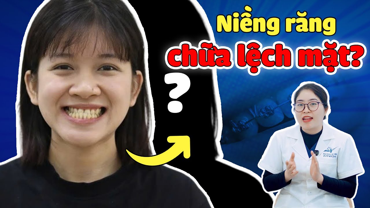 Niềng Răng Chữa Mặt Lệch Được Không? 90% Người Bỏ Sót Bước Quan Trọng Này!
