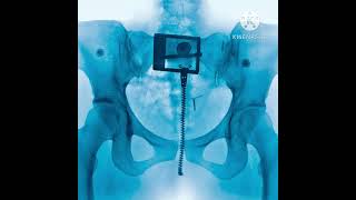 03. Shapeshifter - Lorde Profile