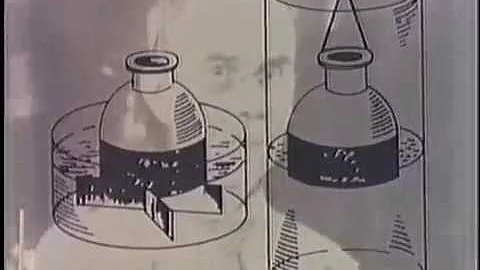 Dialysis A Historical Perspective Narrated by Geor...