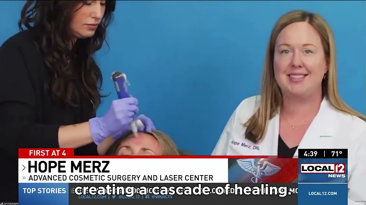 New Microneedling & Exosome Combo: Rejuvenate & Repair Aging Skin!