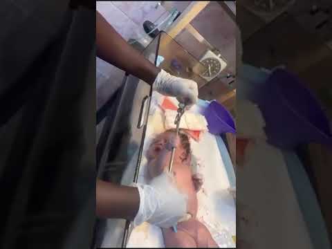 New born baby  wrestles with doctor after birth@starconnectmedia