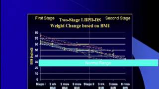 Duodenal Switch Duodenal Switch
