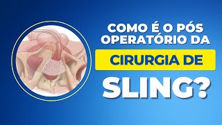 Como É O Pós Operatório Da Cirurgia De Sling?