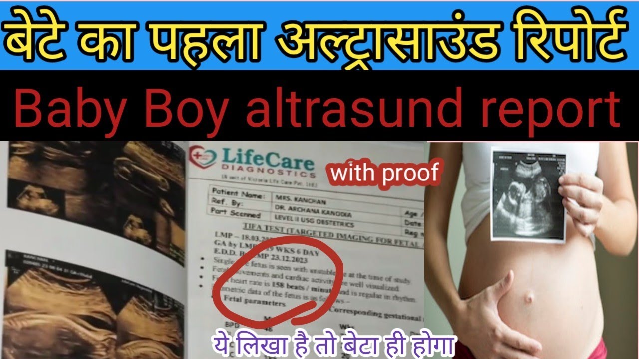 🤱My first baby Boy Ultrasound Report. अल्ट्रासाउंड से कैसे जाने लड़का
