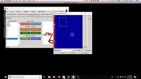 XRF Imaging : Quantification of Image data