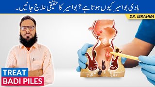 Badi Bawaseer Ka Ilaj - Piles/Hemorrhoids Causes & Treatment - Piles Ka Ilaj - Urdu/Hindi screenshot 4