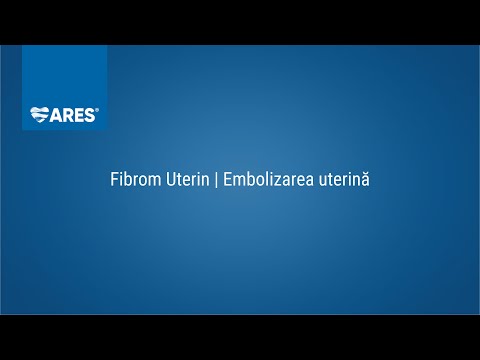 Video: Fibrom Pe Picior, Fibrom Osos