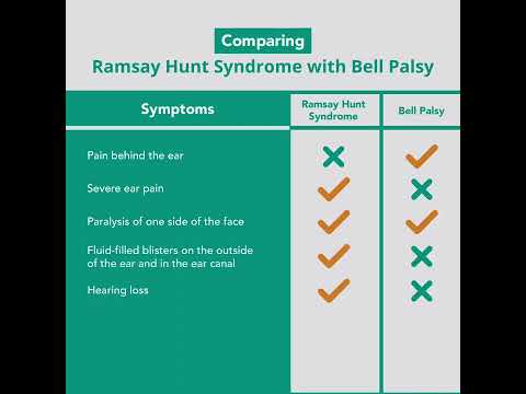 Comparing Ramsay Hunt Syndrome with Bell's Palsy | Merck Manuals