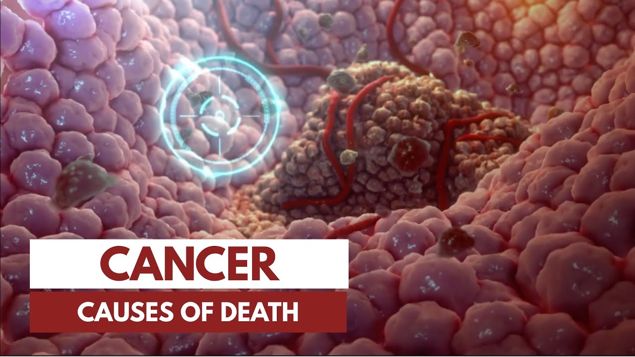 ⁣How does a person die from cancer? | 3D Animation