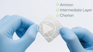 Revita: The Next Generation Placental Allograft