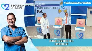 Conoce los tipos de cáncer de piel y sus diagnósticos