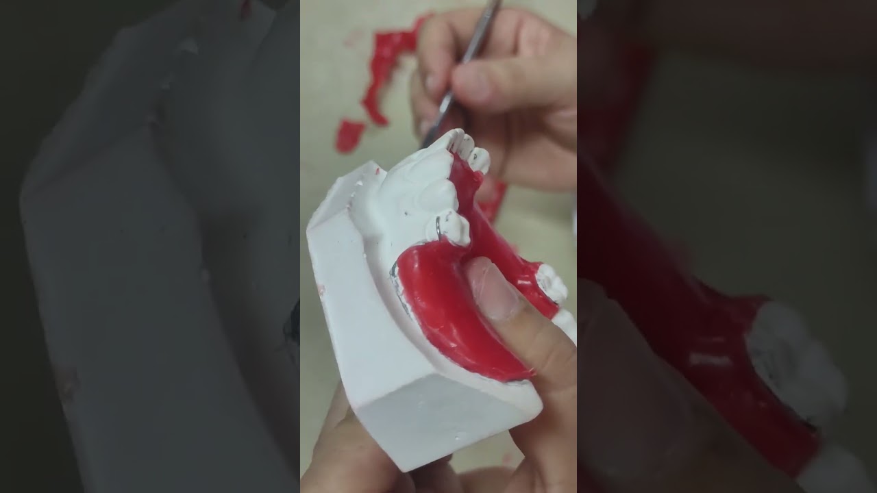 مرحلة ثالثة. عمل الريكورد بيز والبايت لكاست اللور