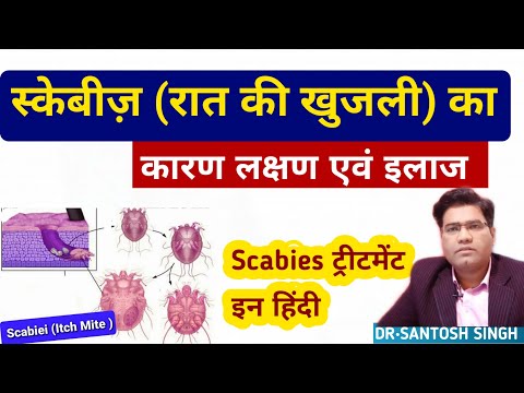 What Are Scabies Signs Symptoms, Causes and Treatment | स्केबीज़ (रात की खाज खुजली)