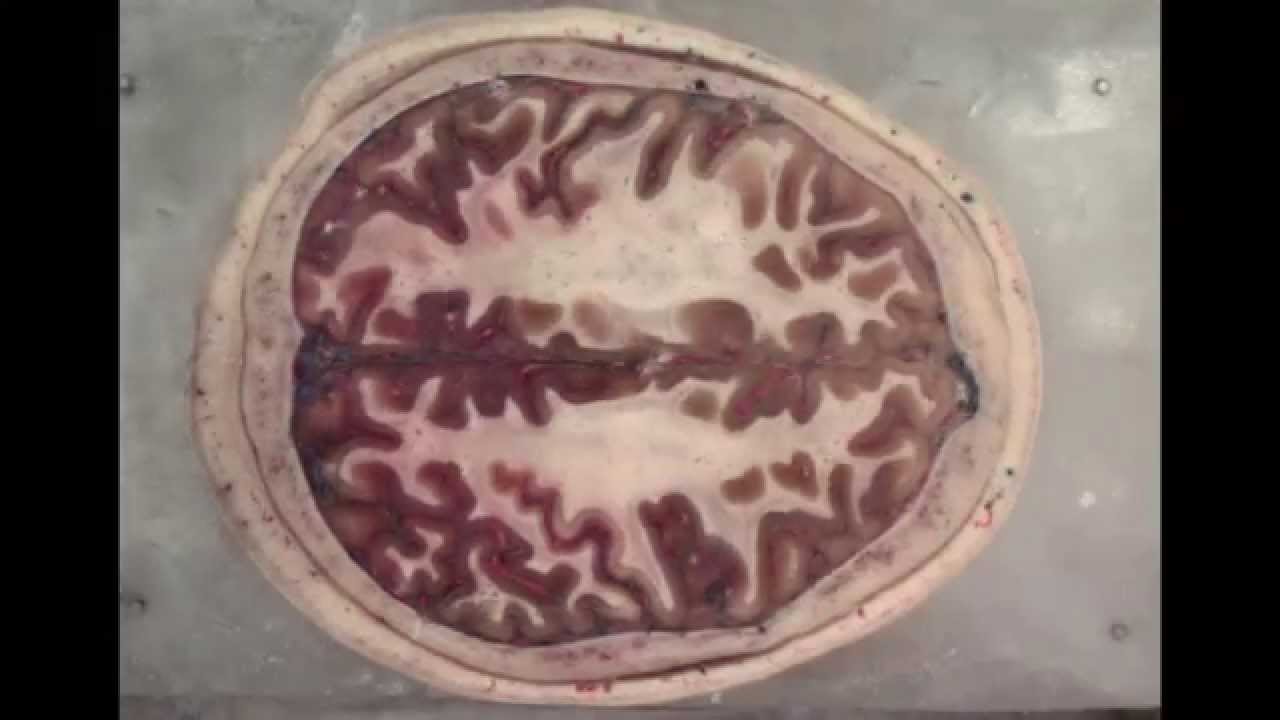 Inside The Brain  An Entire Head In Cross-section