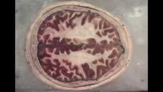 Inside the Brain: An Entire Head in Cross-Section