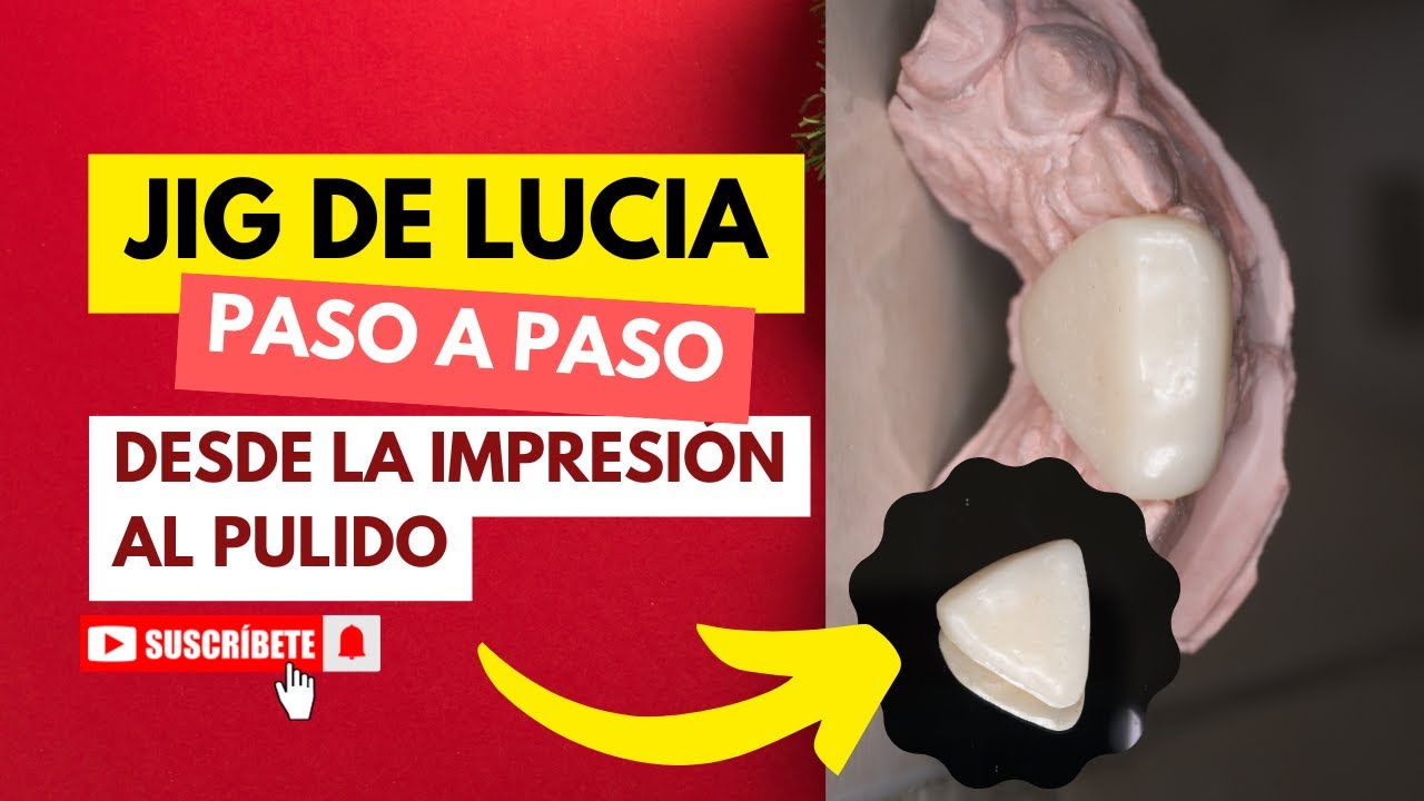 Elaboración del Jig de Lucía explicado FÁCIL Y PASO A PASO 🦷