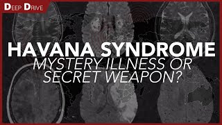 Is Havana Syndrome a Secret Russian Weapon?