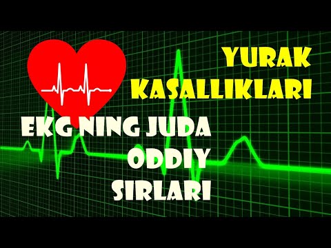 Video: Ekokardiyogramni qanday izohlash kerak: 8 qadam (rasmlar bilan)