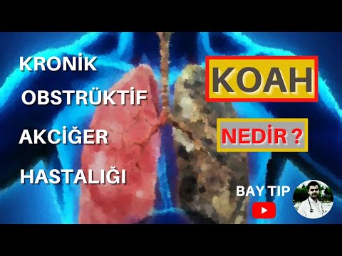 KOAH (KRONİK OBSTRÜKTİF AKCİĞER HASTALIĞI ) NEDİR ?