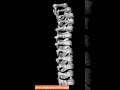 3D rotation view of the thoracic spine #spine #3d #rotation #thoracic #shortsyoutube #shortvideo