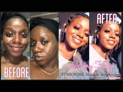 How I Cleared My Dark Spots | Hyperpigmentation Using Only MaryKay Products!! TIME WISE &Clear Proof