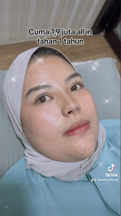 Tanam benang murah Bandung