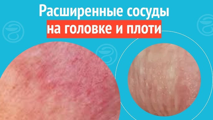 Ең әдемі порно фильм