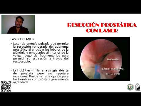 adenoma prostatico liver function