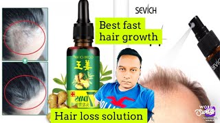 Grow New Hair natural Way | 7 DAYS GINGER GERMINAL OIL | SEVICH HAIR SERUM