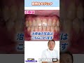 【不自然なセラミックを作り直して若返り】 #shorts