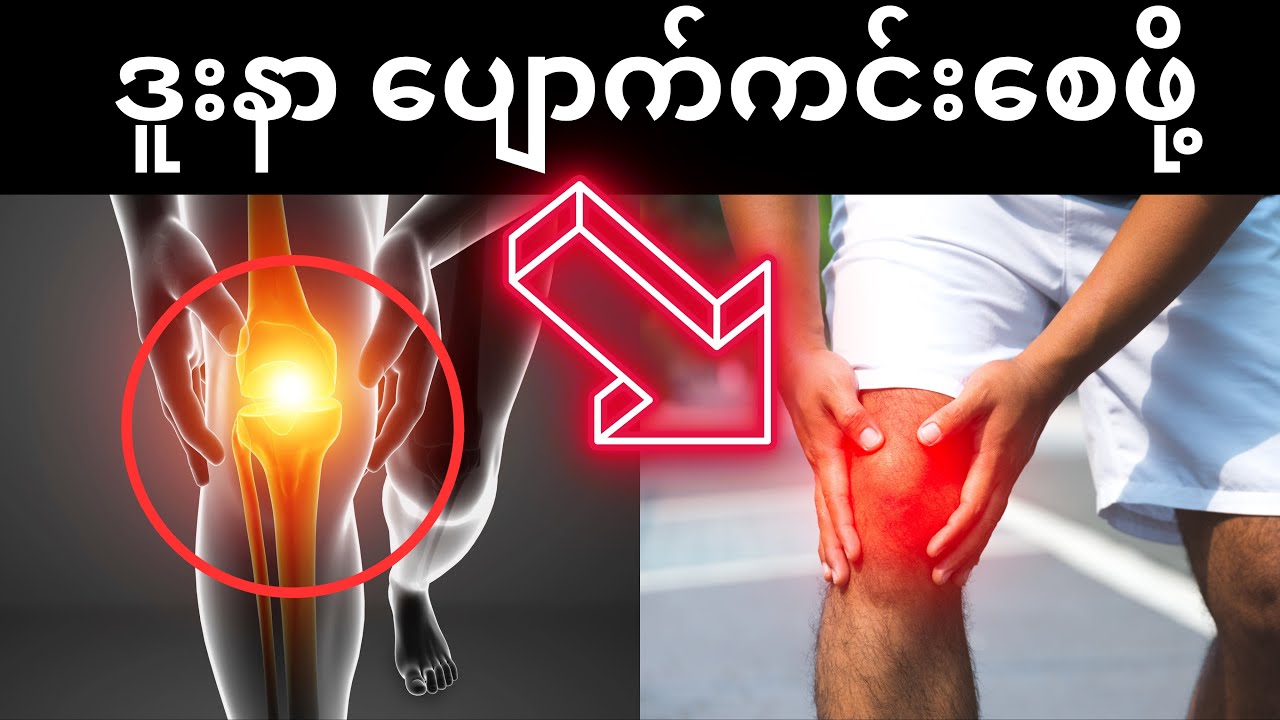 ဒူးနာ ပျောက်ကင်းစေဖို့   - To Relieve Knee Pain @DrYe-