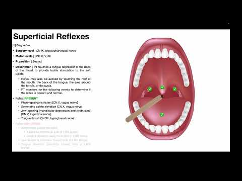 Video: Co je dávivý reflex?
