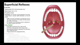 Gag Reflex | Procedure &amp; Results Interpretation