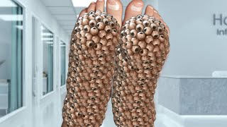 Asmr Animation Incent From Infacted Feet Animation Treatments 2D Animation Deep Cleaning