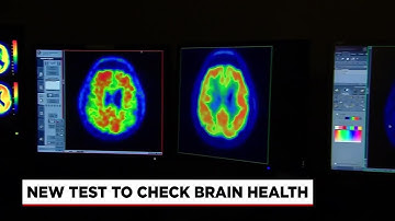 New test could be "game changer" in treating traumatic brain injuries