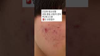 #에스테틱아우라 #kbeauty #원주피부관리 우유니스톤은 샵에서 청소년.노화피부.기미문제성 피부에 임상을 많이 해보니코칭 받고홈케어 병행하면 너무나 뛰어난 약방의 감초 같은 제품