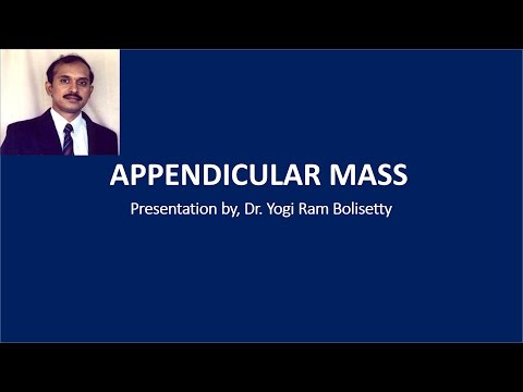 Video: Appendicular Infiltrate - Causes, Symptoms, Diagnosis And Treatment Of Appendicular Infiltrate